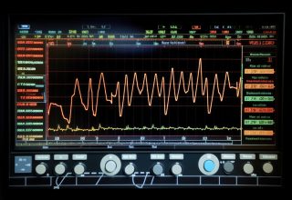 Monitor Noise and Vibration (MNV)